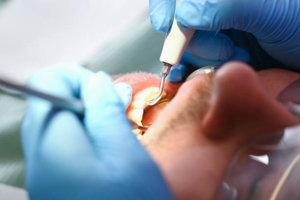 Best Dental Abscess Treatment in Mineralwells, WV
